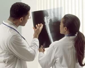Лечение в Израиле: перелом шейки бедра imedical.ru
